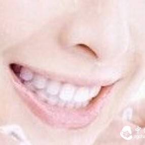 Chewing tea leaves can relieve tooth sensitivity