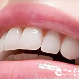 Does Drinking Tea Really Cause Teeth to Turn Black or Yellow?