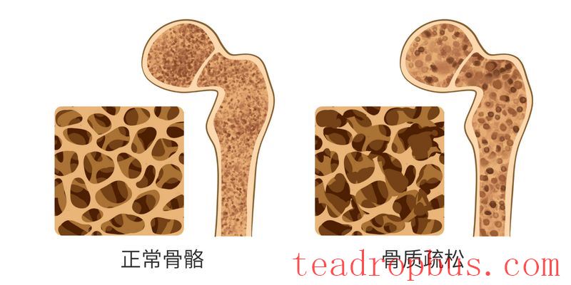 Rumors about tea causing calcium loss? Here's the truth!-2