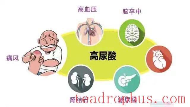 Academy Member Liu Zhonghua's Team on the Uric Acid Lowering Effect and Mechanism of Anhua Dark Tea-3